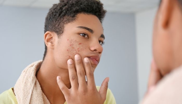 Common Skin Concerns Faced by Men.jpg